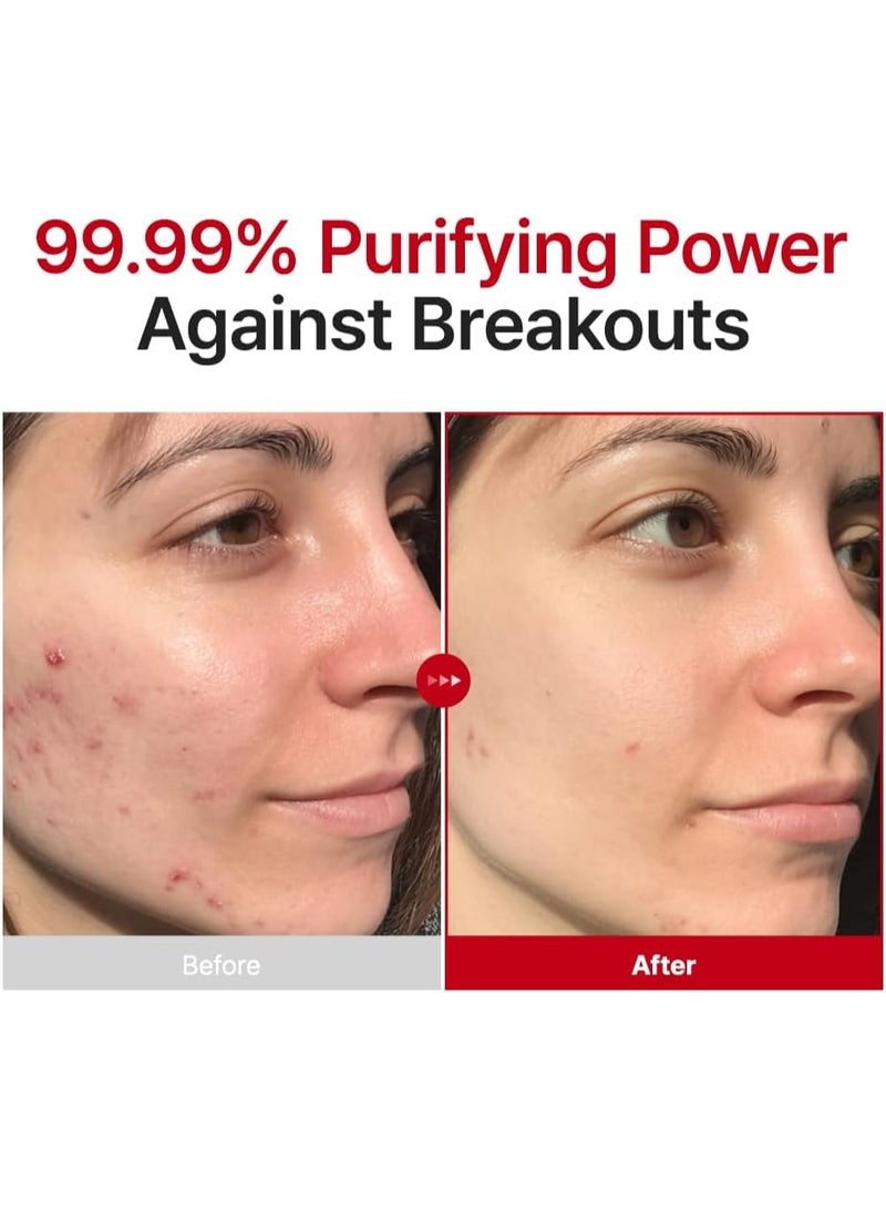 PURITO Hypochlorous Acid Facial Spray | Witch Hazel 5% + Forest Breeze | HOCl Facial Mist for Sensitive, Redness-Prone Skin | Refreshing Toner Mist | Korean Skincare, 100mL / 3.38 fl.oz - Image 3